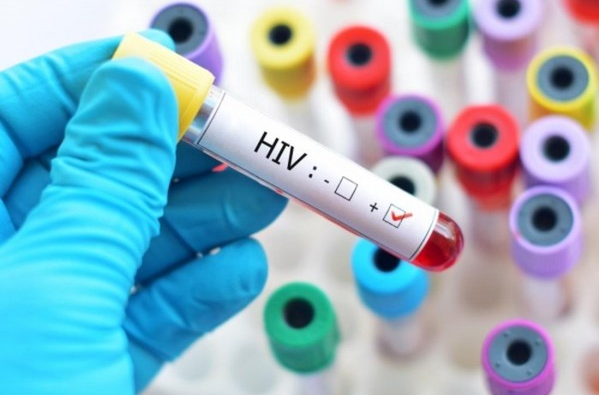Đề xác định người bị phơi nhiễm HIV do tai nạn rủi ro nghề nghiệp - Ảnh 1.