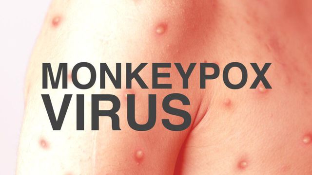 Đối tượng nào dễ bị tình trạng đồng nhiễm đậu mùa khỉ và HIV?- Ảnh 1.