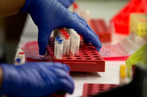 Mỹ bắt đầu thử nghiệm lâm sàng vaccine ngăn ngừa HIV - Ảnh 1.