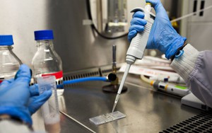 Nghiên cứu mới kiểm soát bệnh nhiễm trùng cơ hội ở bệnh nhân HIV/AIDS