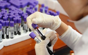 Quảng Ngãi: Gia tăng ca nhiễm HIV ở người trẻ do quan hệ tình dục không an toàn