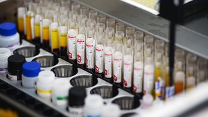 Israel phát hiện protein có thể chữa HIV