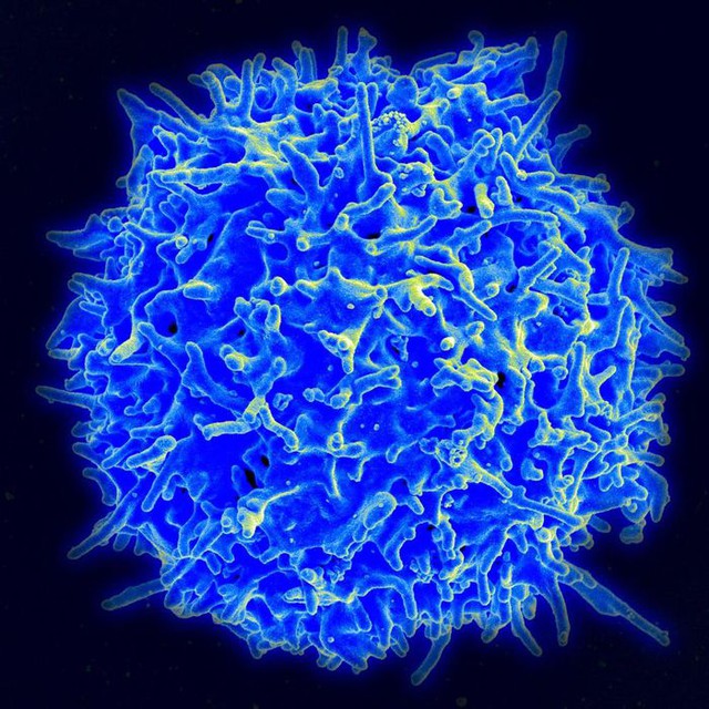 Vaccine mRNA sẽ trị bệnh ung thư, HIV/AIDS như thế nào - Ảnh 2.