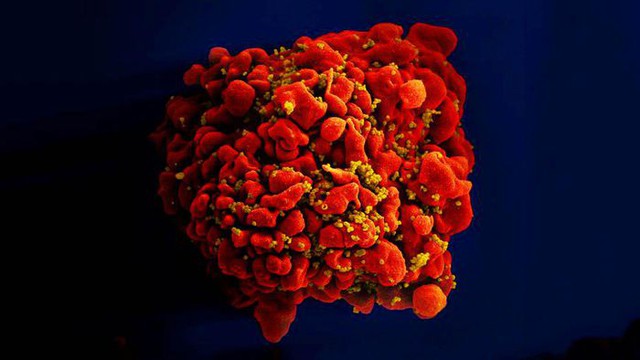Phát hiện chủng virus HIV mới với độc lực cao ở Hà Lan - Ảnh 1.