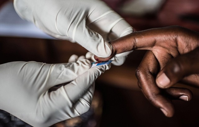 Chung tay giúp nam giới ứng phó với HIV ở Đông và Nam châu Phi - Ảnh 1.