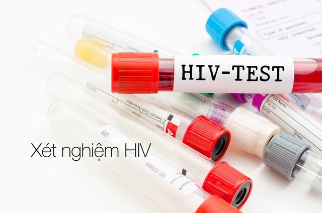 Xét nghiệm máu bình thường có phát hiện ra HIV không? - Ảnh 1.