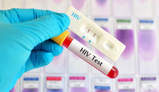 Bảo mật thông tin khi tham gia ứng dụng xét nghiệm nước bọt giúp phát nhiễm HIV- Ảnh 1.