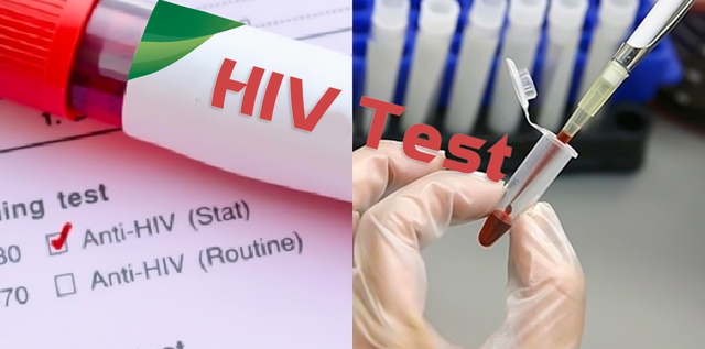 Chế độ báo cáo định kỳ hoạt động phòng, chống HIV/AIDS - Ảnh 1.