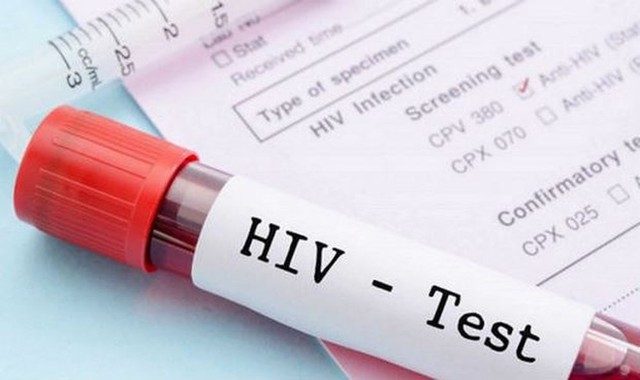 Danh mục nghề phải xét nghiệm HIV trước khi tuyển dụng- Ảnh 1.