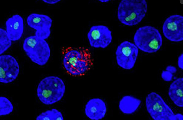 Nghiên cứu mới về khả năng kiểm soát HIV mà không cần dùng thuốc- Ảnh 1.