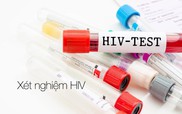 Xét nghiệm máu bình thường có phát hiện ra HIV không?
