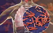Nâng cao chất lượng dịch vụ chăm sóc người đồng nhiễm HIV/lao