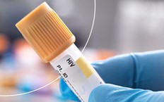 Anh hy vọng là quốc gia đầu tiên ‘đánh bại’ HIV vào năm 2030