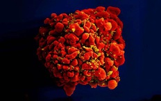 Phát hiện chủng virus HIV mới với độc lực cao ở Hà Lan