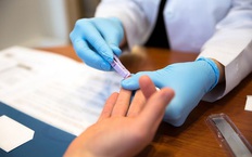 Vai trò của xét nghiệm đếm tế bào T-CD4 trong điều trị HIV/AIDS