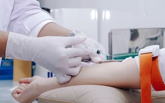 Điều trị vi khuẩn cryptococcus ở người nhiễm HIV