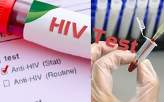 Chế độ b&#225;o c&#225;o định kỳ hoạt động ph&#242;ng, chống HIV/AIDS