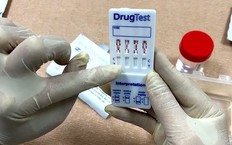 Trạm y tế được thực hiện gói dịch vụ phòng, chống HIV/AIDS; xác định tình trạng nghiện ma túy