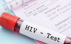 Danh mục nghề phải x&#233;t nghiệm HIV trước khi tuyển dụng