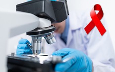 Đức phát hiện kháng thể khả năng trung hòa virus HIV hiệu quả cao