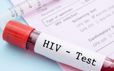 Phát triển công nghệ mới xét nghiệm HIV tại chỗ chính xác trong vài phút