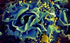 Một bệnh nhân được chữa khỏi HIV nhờ ghép tế bào gốc của anh trai