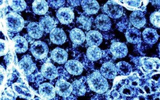 Nghi&#234;n cứu sự li&#234;n quan giữa c&#225;c biến thể của virus SARS-CoV-2 v&#224; HIV