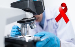 Đức phát hiện kháng thể khả năng trung hòa virus HIV hiệu quả cao