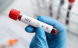 Vaccine mRNA mở ra hướng tiếp cận mới trong kiểm soát HIV