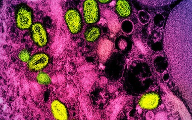 WHO: Người nhiễm HIV nên xét nghiệm phát hiện sớm bệnh đậu mùa khỉ