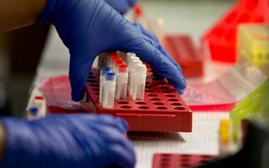 Mỹ bắt đầu thử nghiệm lâm sàng vaccine ngăn ngừa HIV