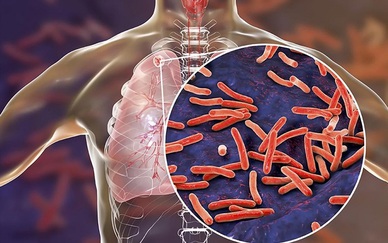 Nâng cao chất lượng dịch vụ chăm sóc người đồng nhiễm HIV/lao