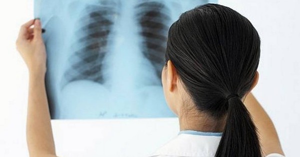 Từ vựng y khoa bệnh lao phổi tiếng anh là gì phổ biến ở Việt Nam