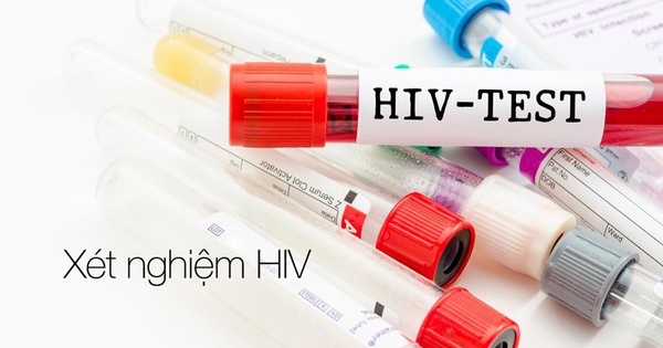 Ngứa có phải là chỉ định của việc kiểm tra nhiễm HIV hay không?
