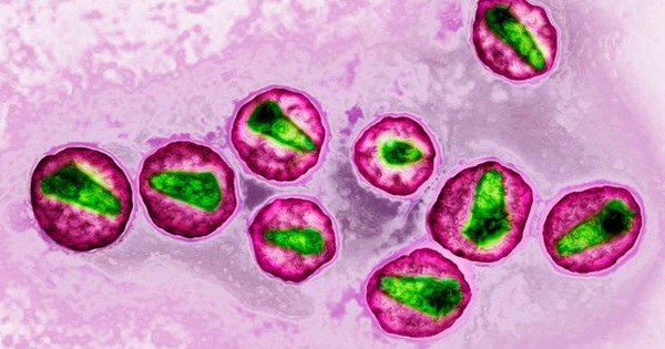 Virus HIV có thể được quan sát dưới kính hiển vi như thế nào?
