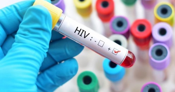 Khi có triệu chứng ngứa, cần phải đến bác sĩ để xét nghiệm HIV ngay lập tức hay không?
