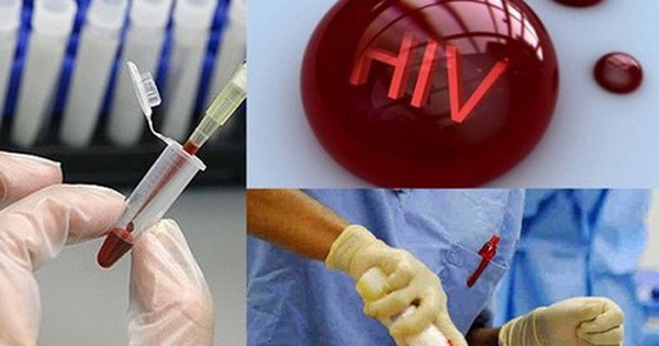 Xét nghiệm HIV combo ag/ab có thể cho kết quả âm tính sau 9 tuần?
