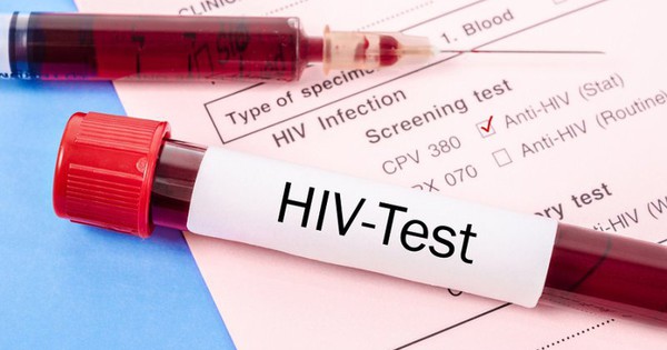 Quy trình xét nghiệm nhiễm HIV sau quan hệ hậu môn là gì?
