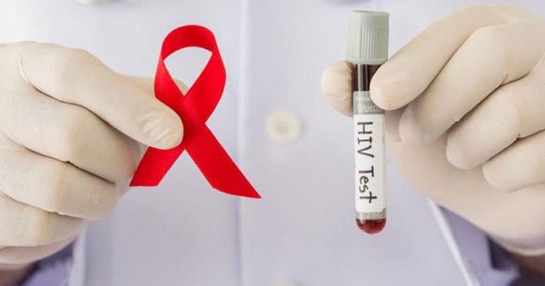 Sức khỏe và y tế HIV RNA là gì và tầm quan trọng của việc xét nghiệm